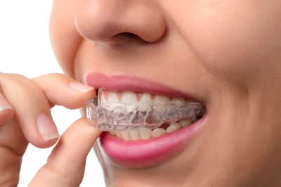 This is the image for the news article titled The Advantages of Invisalign